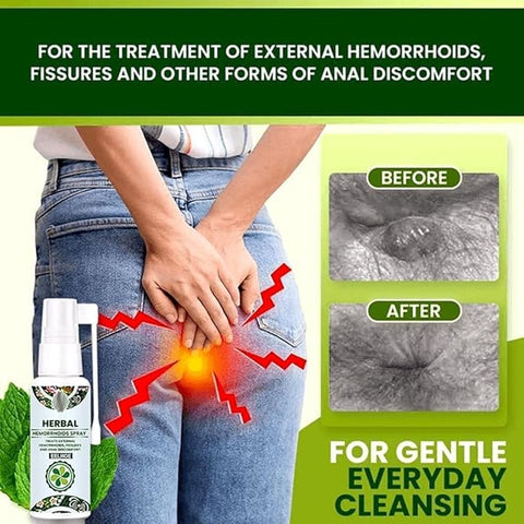 Herbal Piles – Hemorrhoids Relief Spray