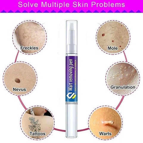 Warts, Moles & Skin Tags Remover Pen